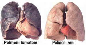 fattori di rischio dei tumori : danni da fumo