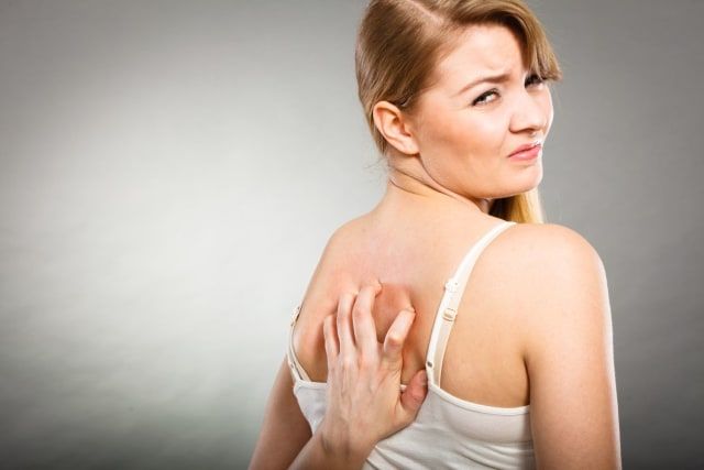 Come sbarazzarsi dell'acne sulla schiena